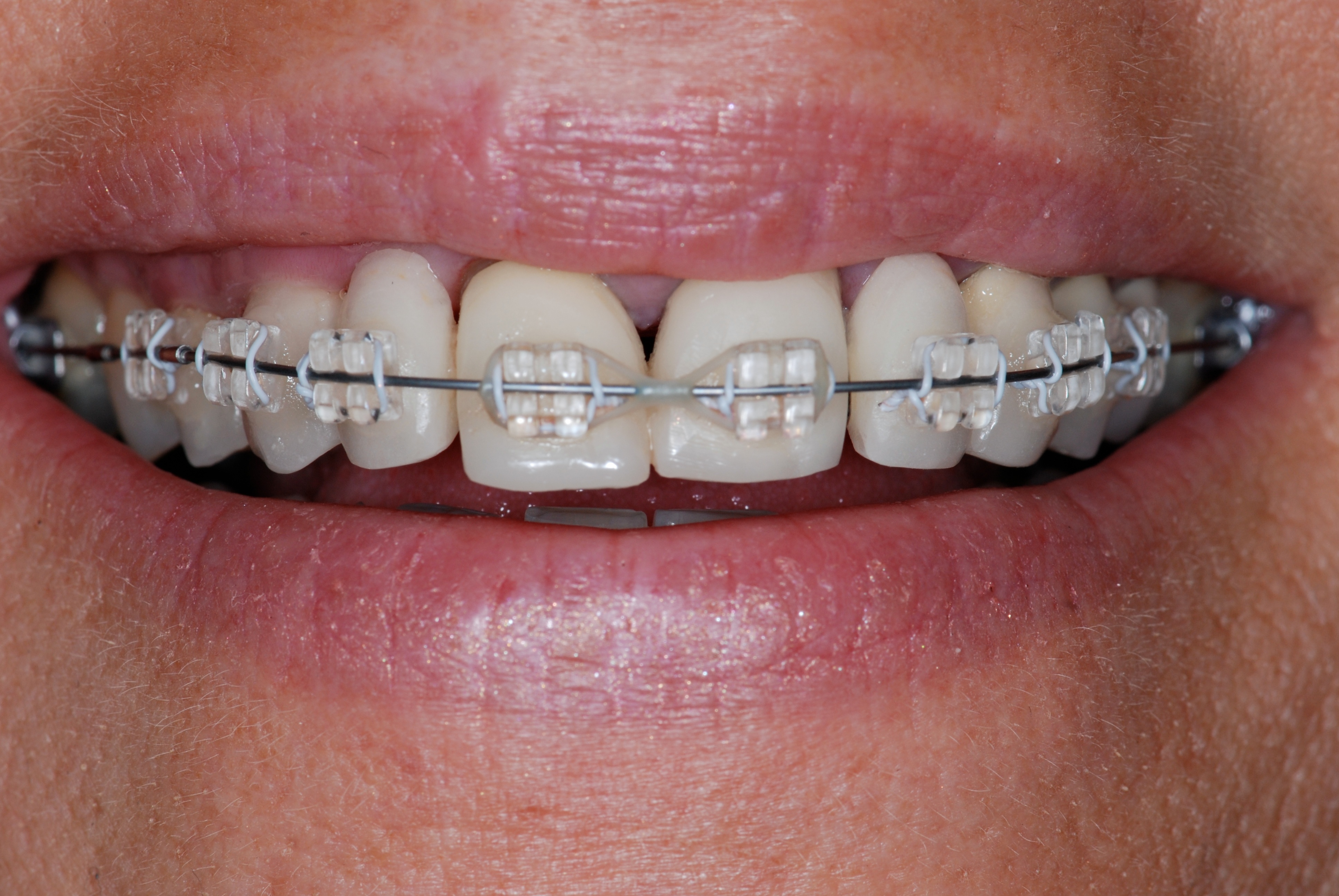 Orthodontics orthodontics